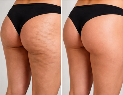 Anti-Cellulite Skin Firming Massage Oil