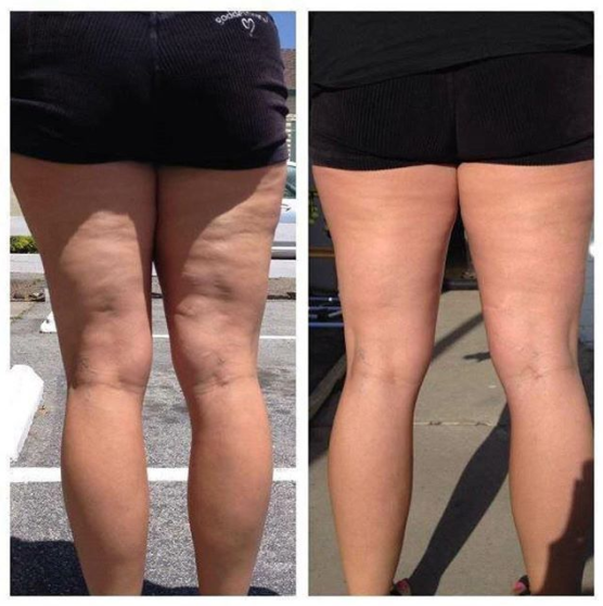 Customer photo