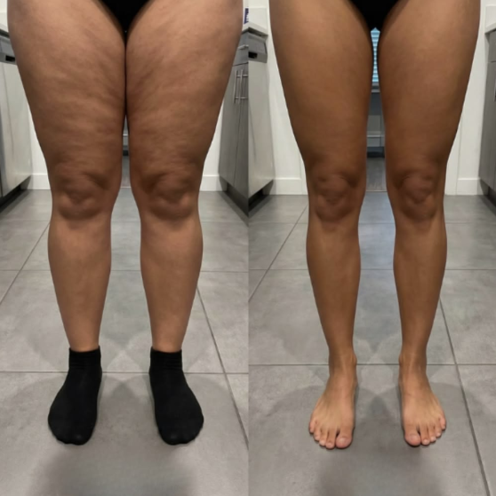 Customer photo