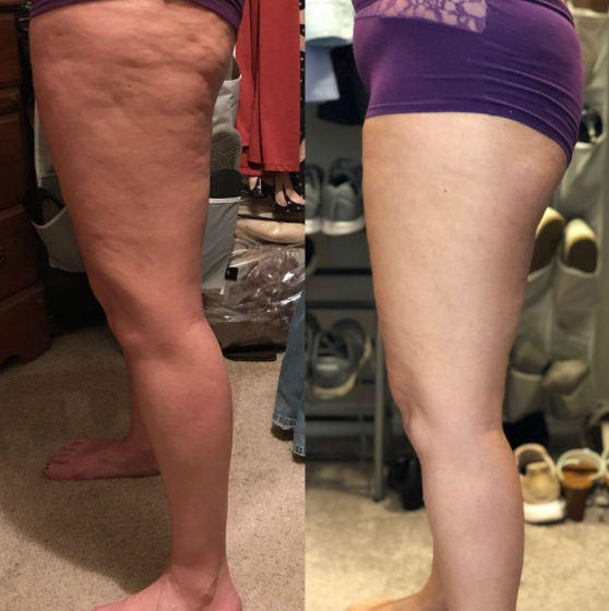 Customer photo
